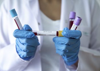 Brojevi telefona koje trebate zvati ako sumnjate da ste zaraženi koronavirusom